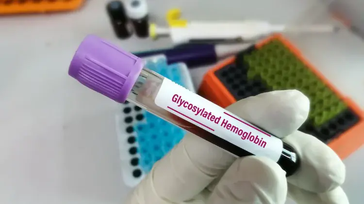 Control de diabetes con la prueba de hemoglobina glicosilada (HbA1c)